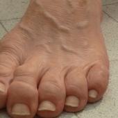 Toes by Ron Mueck